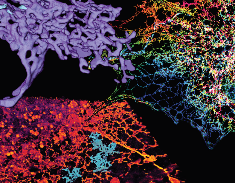 Correlative Light Electron Microscopy Clem Archives Focalplane