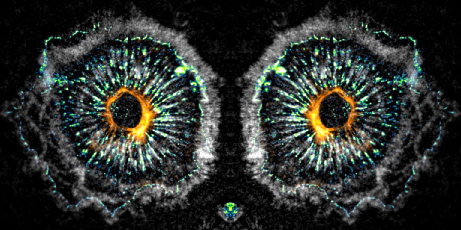 Total Internal Reflection Fluorescence TIRF Microscopy Archives