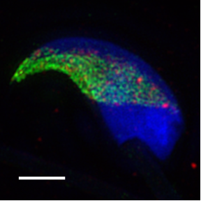 A picture of mouse sperm taken with SIM microscopy, showing co-localisation of CD151 and alpha6 integrin.