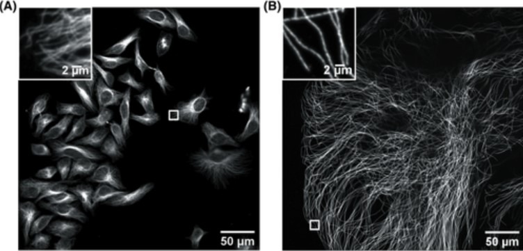 Dragonfly: The Ideal Confocal System for Expansion Microscopy