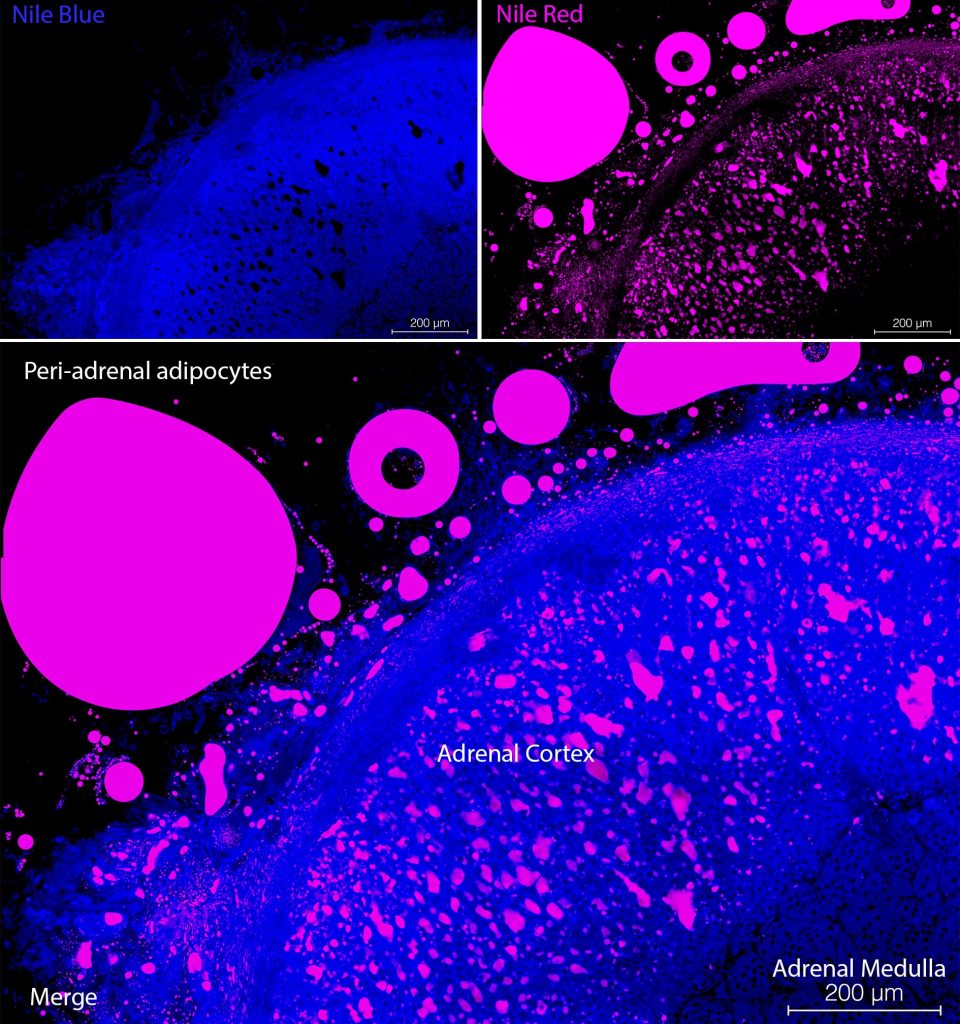 Using Nile Blue and Nile Red to visualise the presence of lipids in  cryosectioned tissues