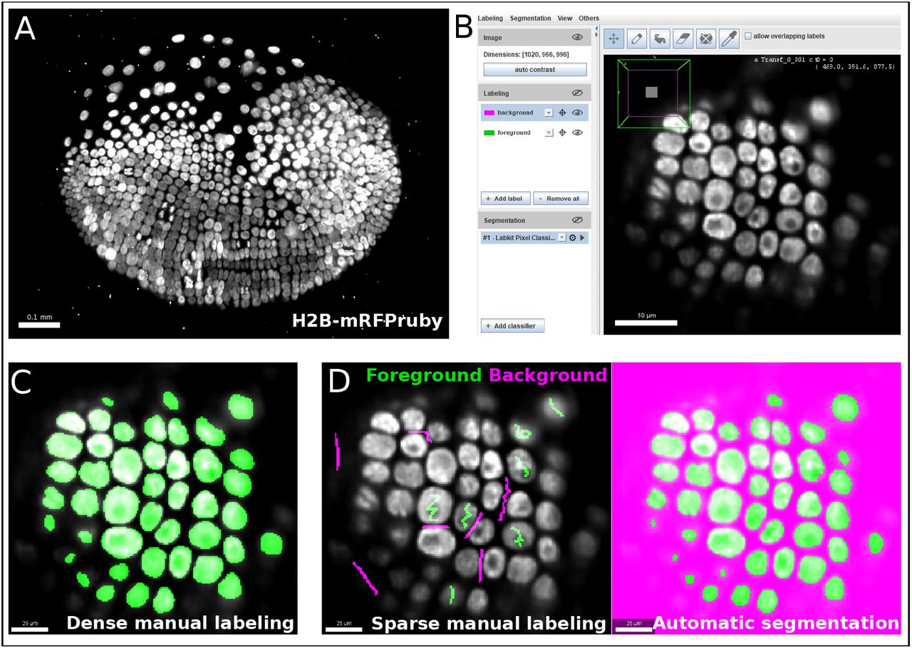 Microscopy preprints - Bioimage analysis tools