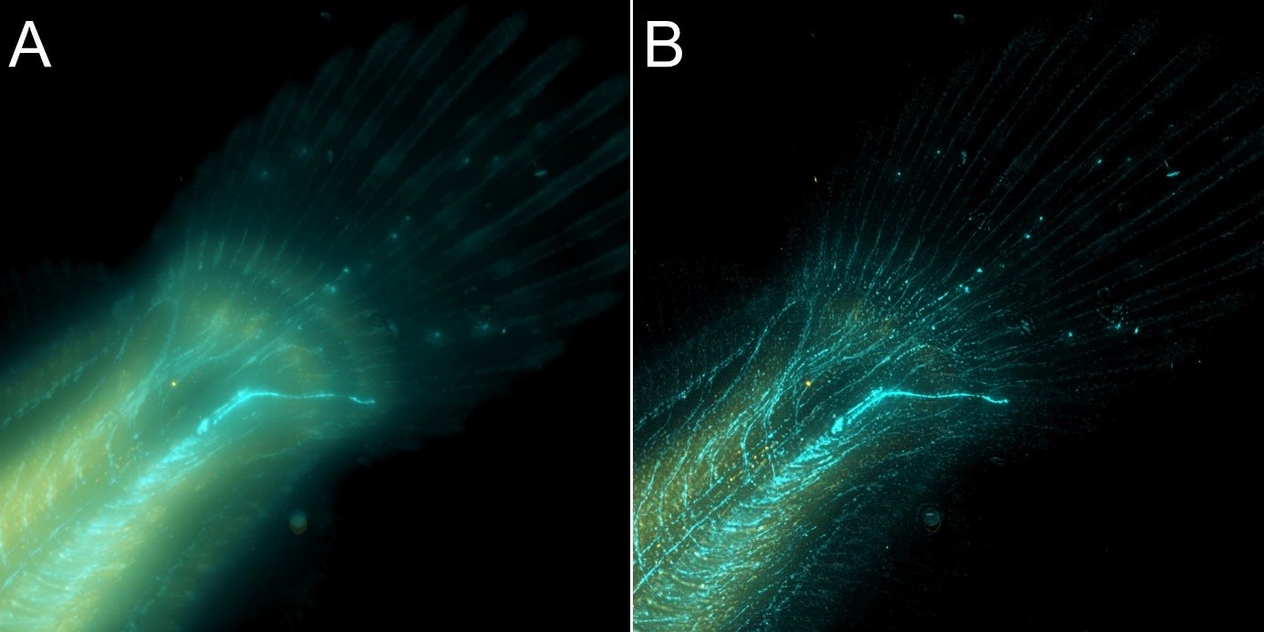 Overview Of Microscopy Techniques: Confocal, Widefield, Transmitted ...