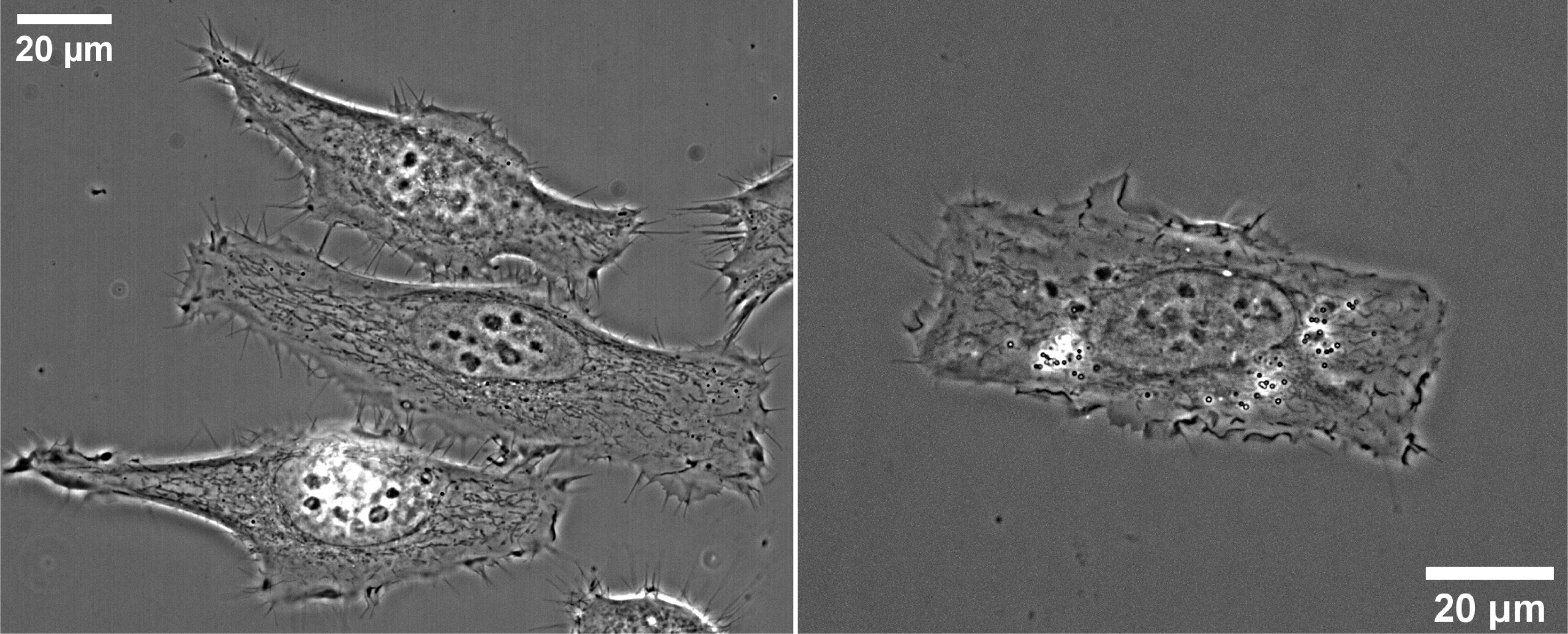 protein-micropatterning-beauty-standards-in-cell-culture-focalplane