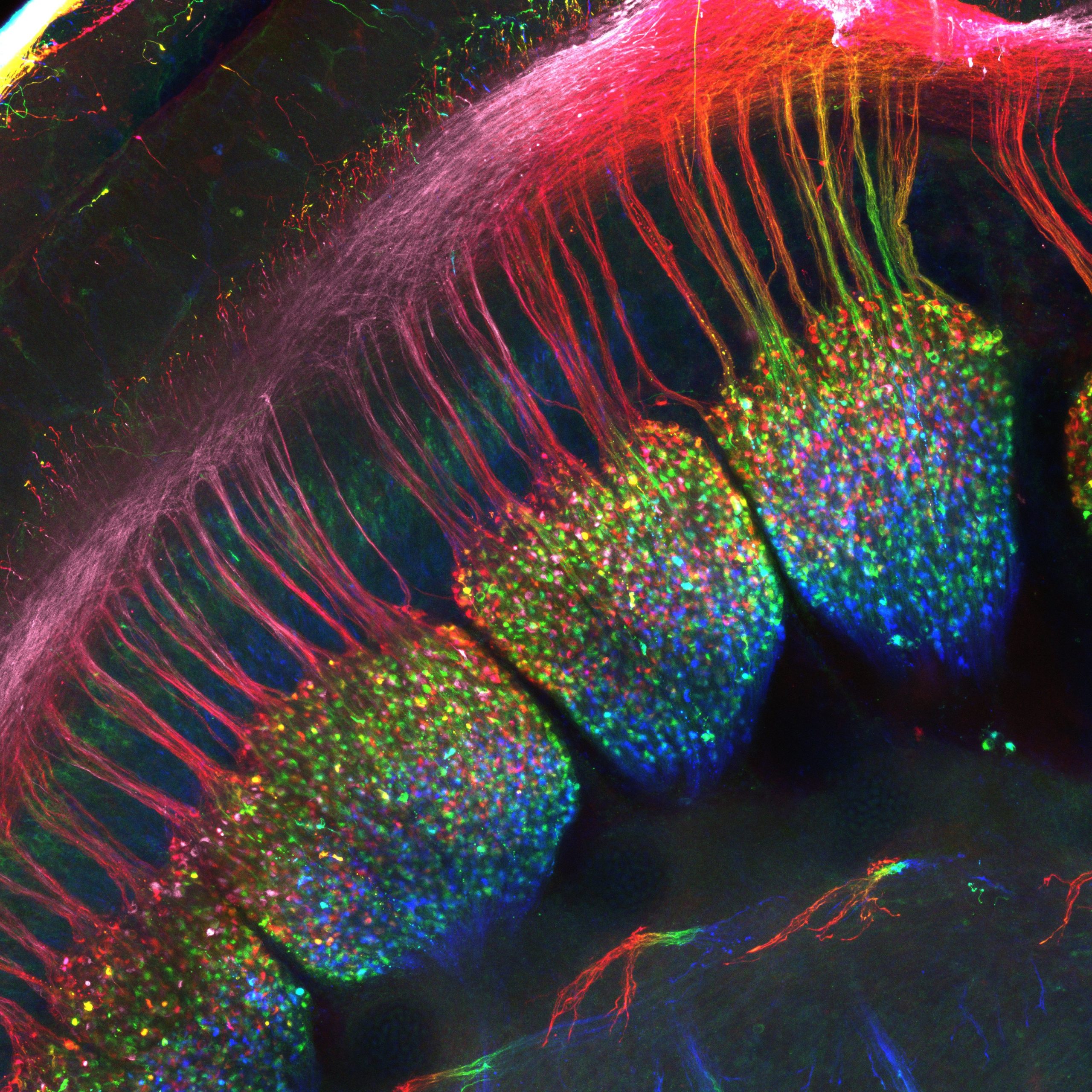 Embryonic dorsal root ganglia