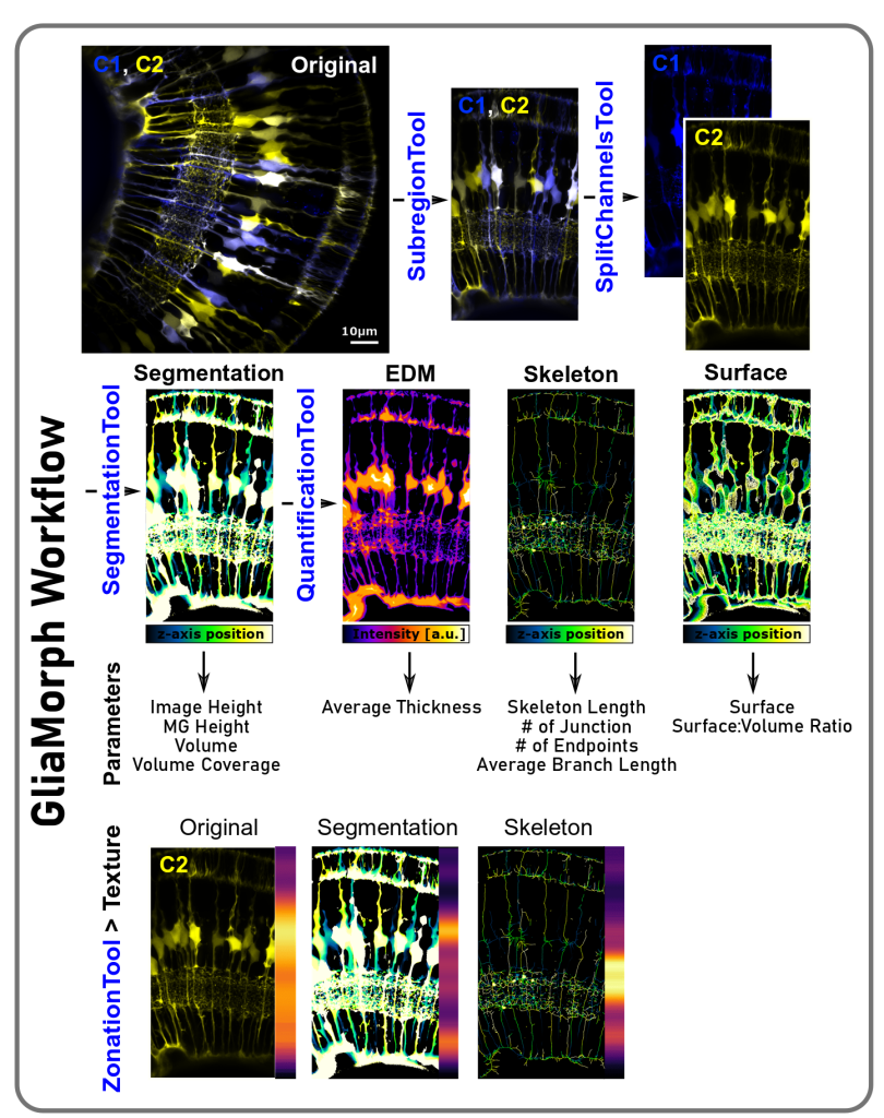 Retina Workflow