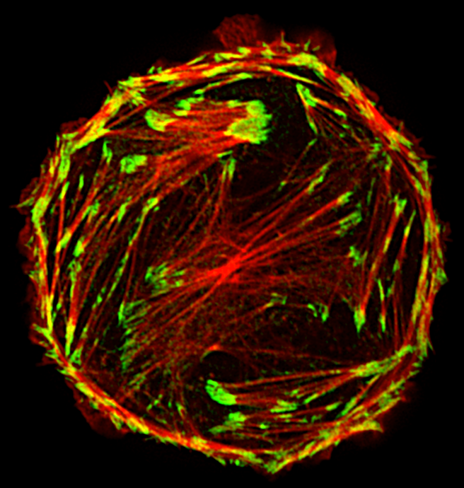 Focal adhesions and F-actin in a rat liver epithelial cell.
