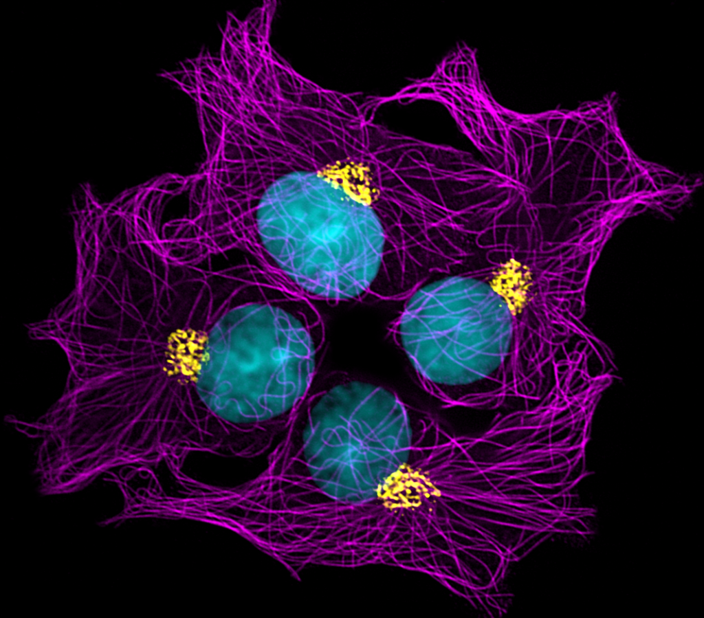 Under high magnification, it shows the stacks of Golgi apparatus