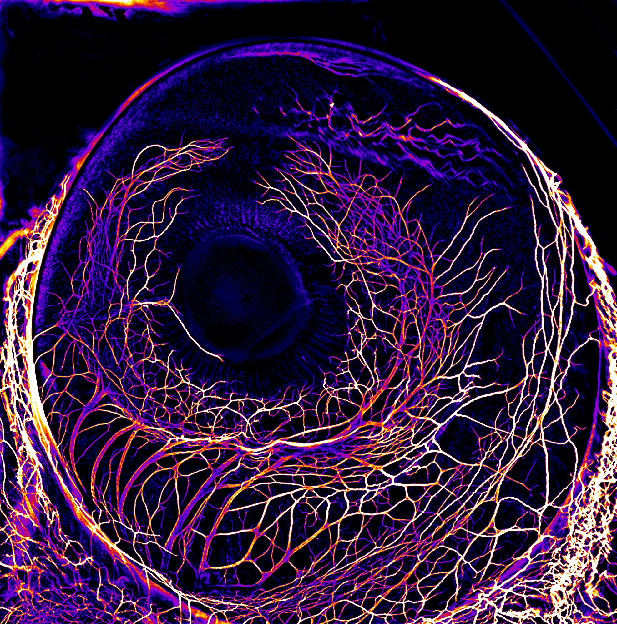 Neurofilament labelling of the eye of a 7-day-old chick embryo