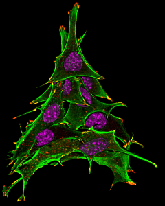 Overlapping Hela cells that look like a Christmas tree