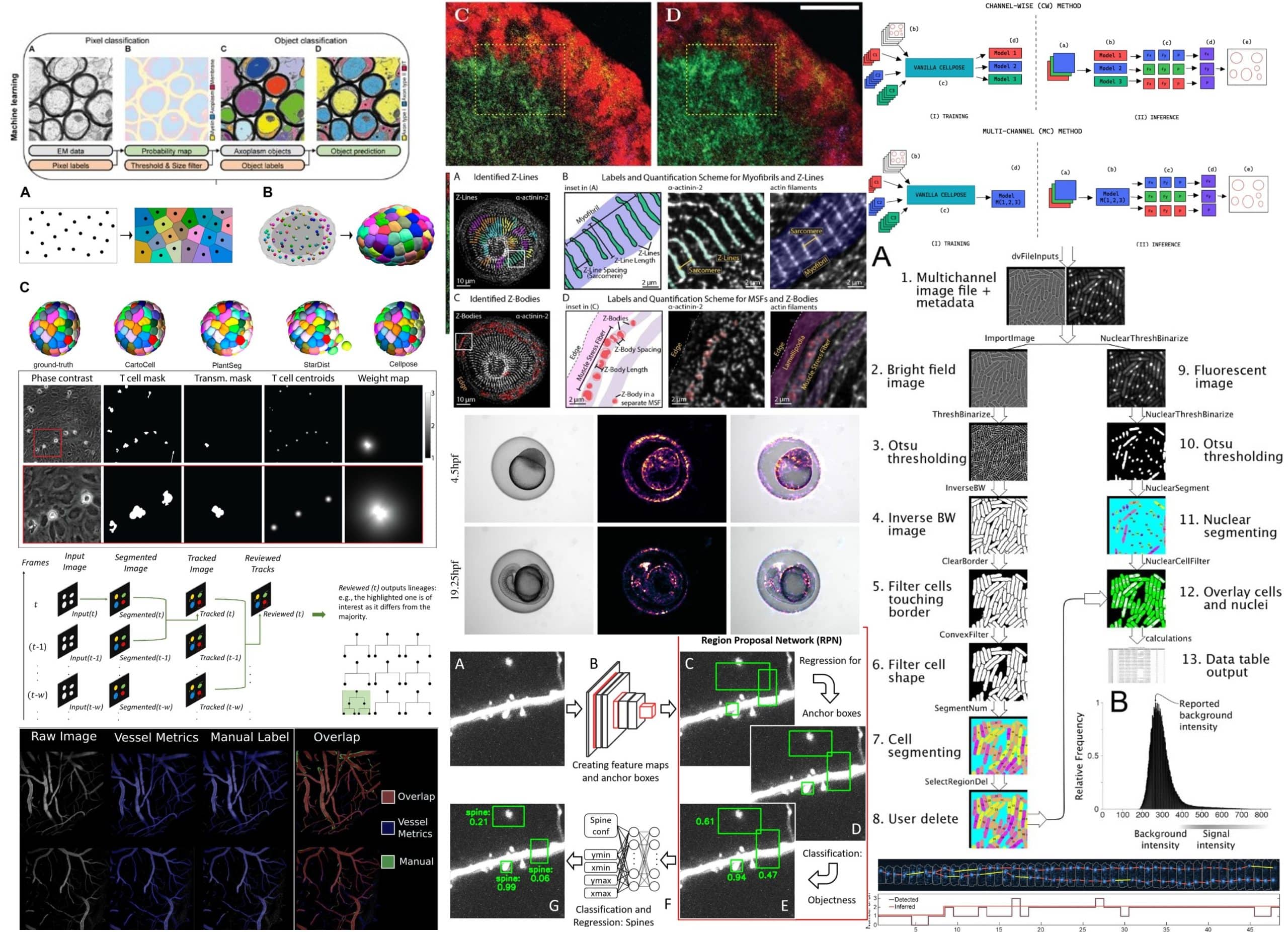 Microscopy Preprints – Bioimage Analysis Tools - FocalPlane