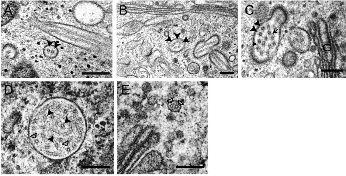 Electron micrographs showing cross sections of Weibel Palade bodies from Zenner and Collinson, et al.