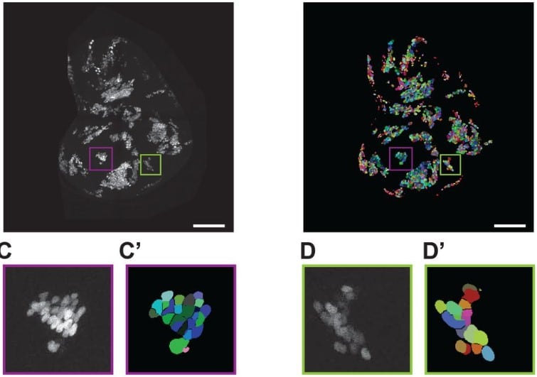 Segmentation of cells within clones in the Drosophila wing disc