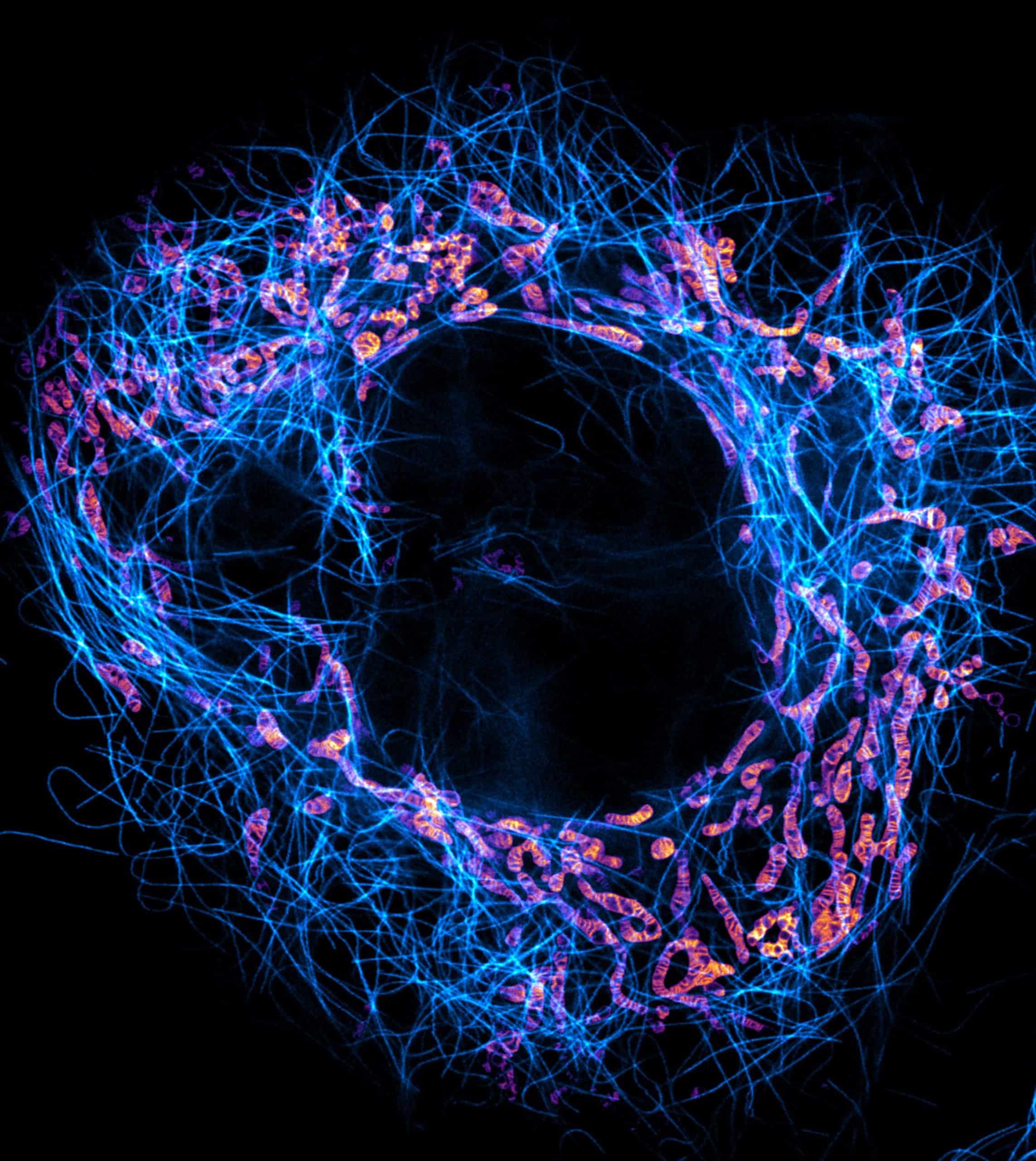 Microtubules and mitochondria imaged by Till Stephan using STED