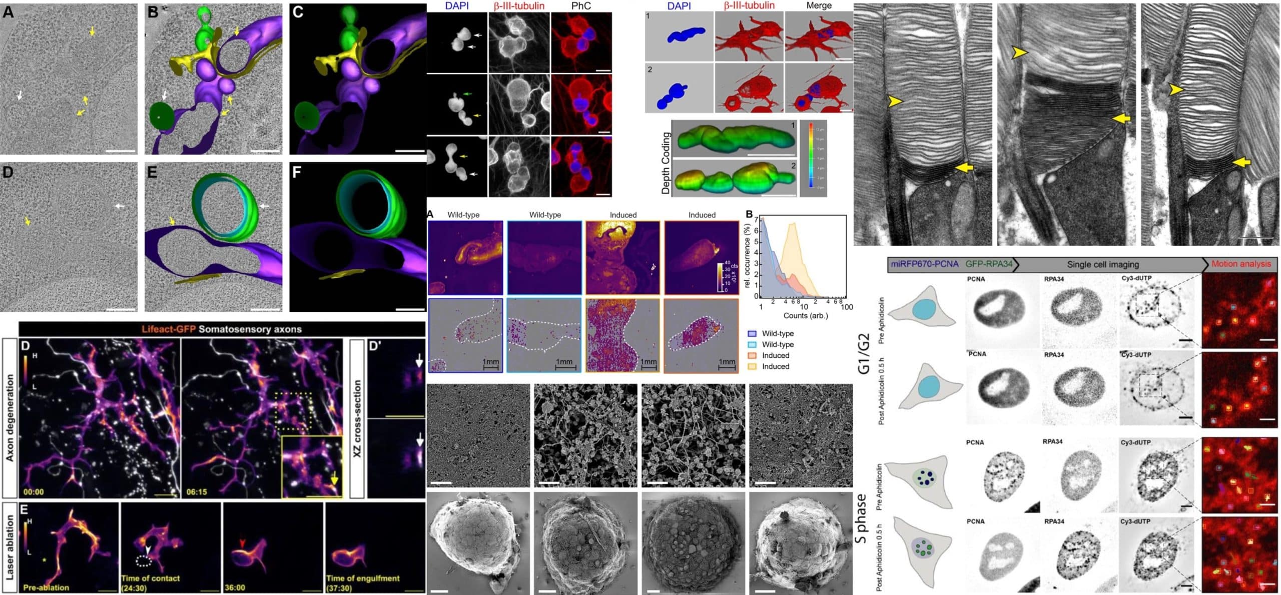 Microscopy preprints – applications in cell and developmental biology ...