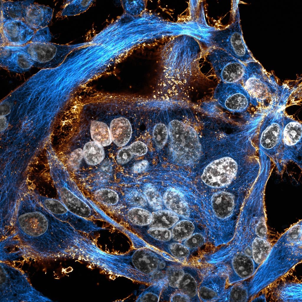 Sci-Art showing image of boa constrictor kidney cells transfected with a fusogenic viral protein.
