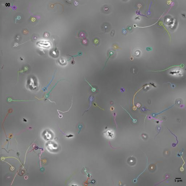 Tracking Helicobacter pylori with TrackMate and YOLO