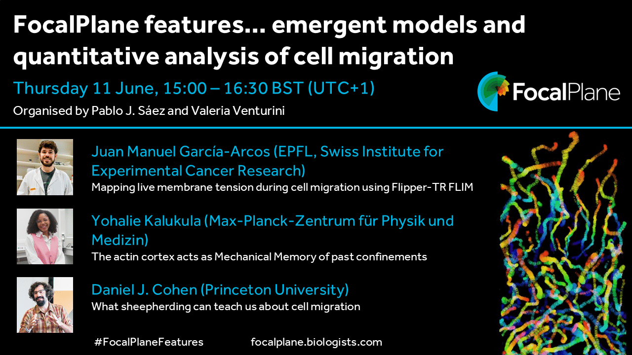 New webinar series on cell migration - FocalPlane