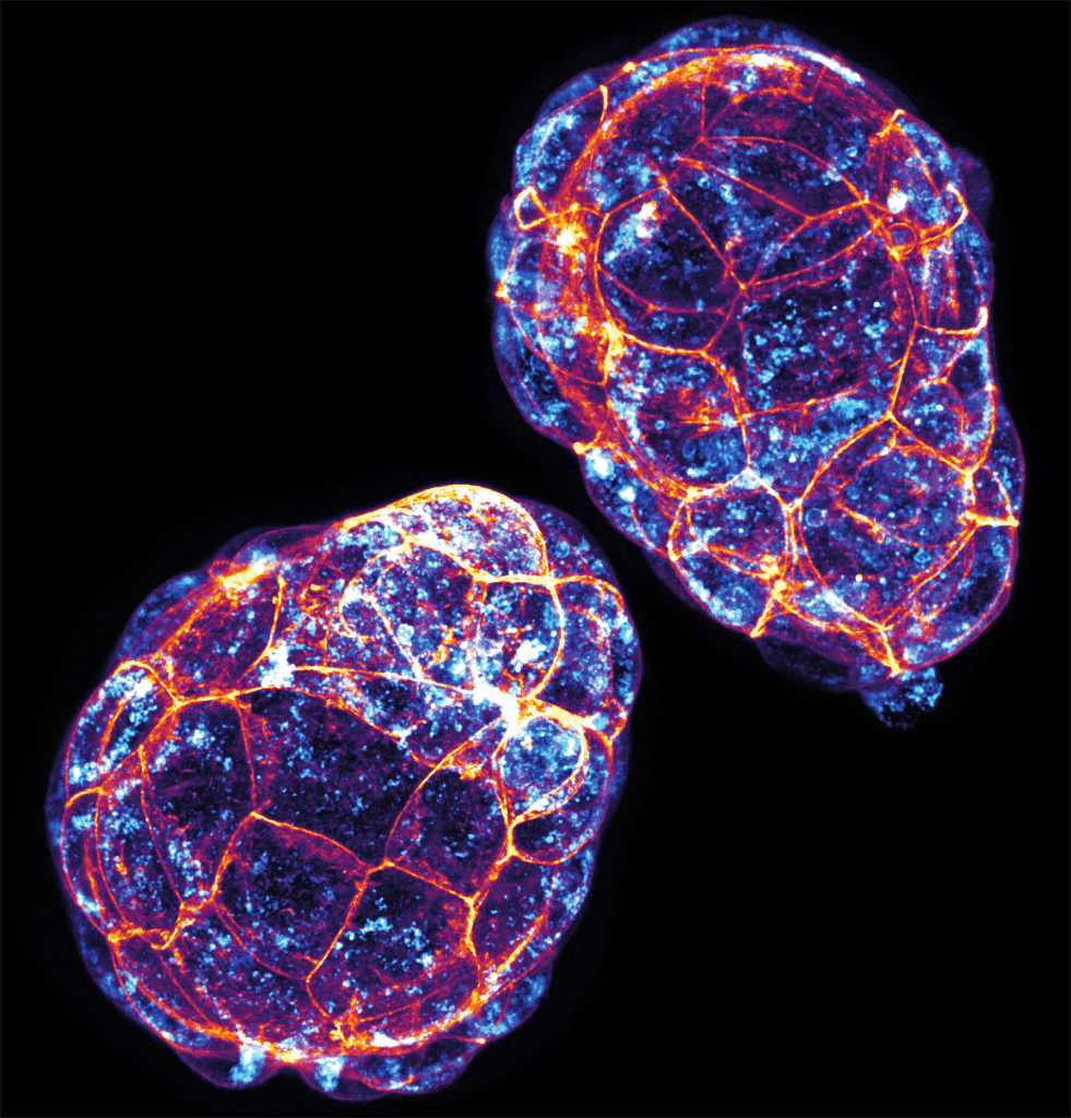 Beautiful image of two mouse preimplantation blastocysts at E4.5 with lysosomes (LAMP1) labelled in blue and cortical actin (phalloidin) labelled in orange.